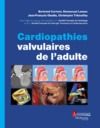 Livro digital Cardiopathies valvulaires de l'adulte