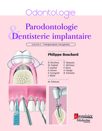 Electronic book Traité de parodontologie - Volume 2 : aspects chirurgicaux
