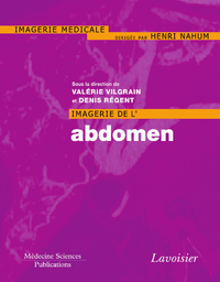 E-Book Imagerie de l'abdomen
